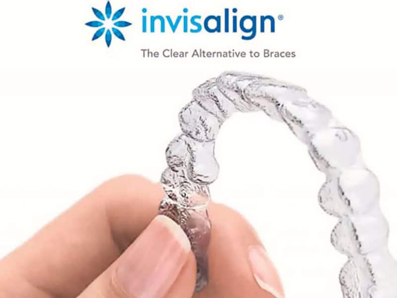 Invisalign Orthodontiste Yvelines Dr SAMAMA à Paris 78110 Vésinet Boucle de seine Pecq Croissy Chatou Houille Montesson Marly Maison Laffitte invisalign