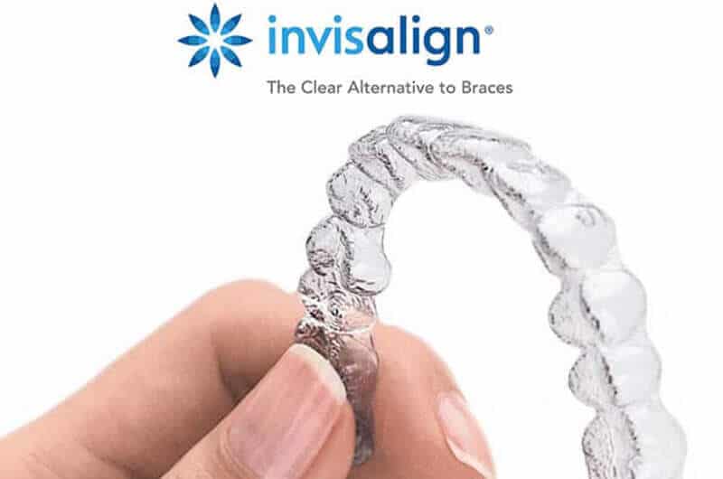 Orthodontiste Yvelines Paris Docteur Samama Orthodontiste invasilign Vesinet Boucle de seine Pecq Croissy Chatou Houille Montesson Marly Maison Laffitte invisalign